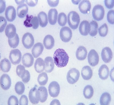 Plasmodium vivax Plasmodium vivax